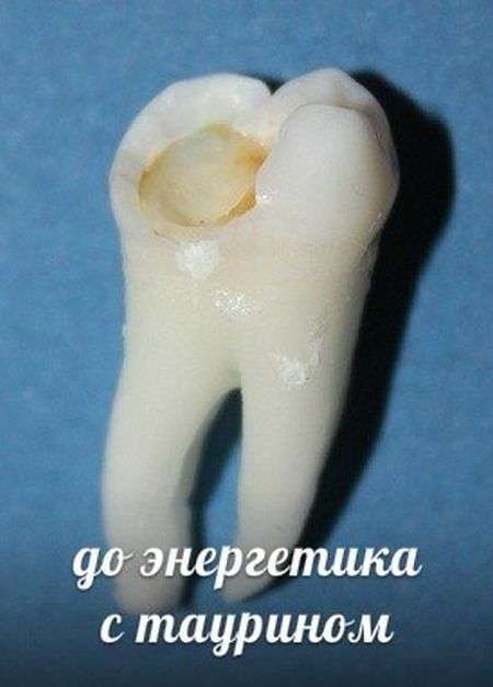 ТОП-10 напоїв, які руйнують наші зуби (10 фото)